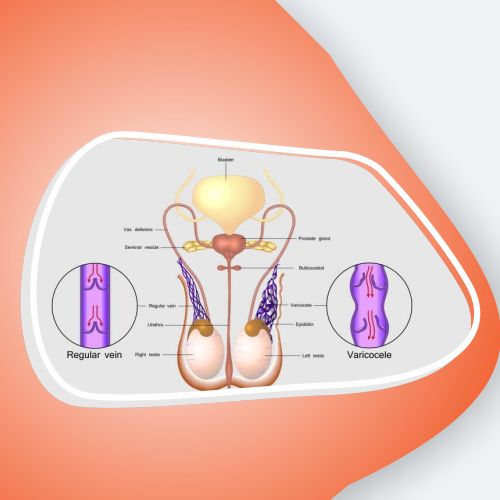 Gastrointestinal Hepatobiliary Treatment in lucknow